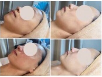 エスビューティー 三軒茶屋(S beauty)/たるみ・池尻大橋・痩身