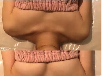 レーヴ(Reve)/バストアップ!