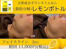 美々庵/レモンボトル/小顔/ブライダル