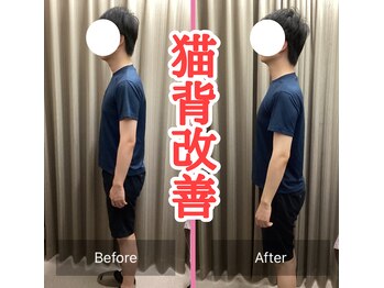 カーム 天白区野並(calm)/ストレートネック