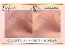 リーズリアン(Rises Lien)/【BeforeAfter】アクアピール