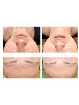 お肌をきれいにしたい