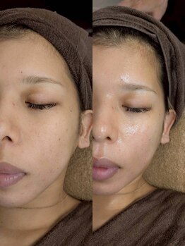 ギンザ リボーン(Ginza Reborn)/ダクトピールビフォー→アフター