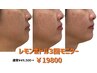 【モニター価格】小顔レモンボトル3回￥19800