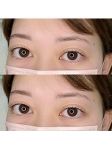 プペ(Pupe)/フラットラッシュ