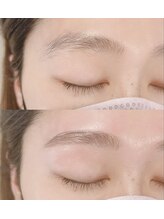 ルポ(space repos)/眉毛before after