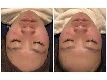 ダーナ(Danam)/ゆがみ改善！左右差も軽減！