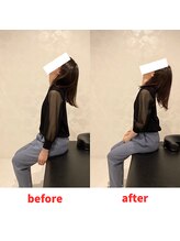 ナオル整体 福岡香椎院(NAORU整体)/30代女性施術事例【首こり】