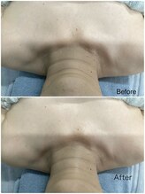 ウルーフ(ulu-fu)/BBLボディートリートメント