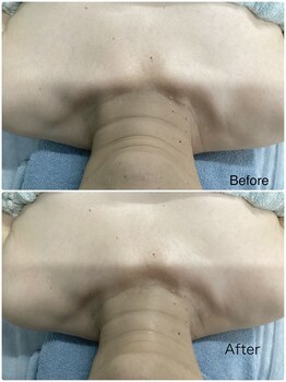 ウルーフ(ulu-fu)/BBLボディートリートメント