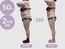 ビップ 赤坂店(Bipp!)/50代・2カ月の変化