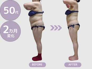 ビップ 赤坂店(Bipp!)/50代・2カ月の変化