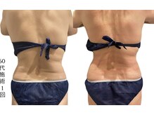 ラリマ(La-lima)/60代/首肩凝りウエスト太り悩み