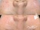 エヌエー(Na)の写真
