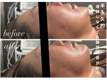 ビノスビューティー(vinos.beauty)