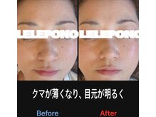 美容矯正サロン レレポノ(LELEPONO)/