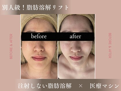 エフリア 大垣(F.lia)の写真