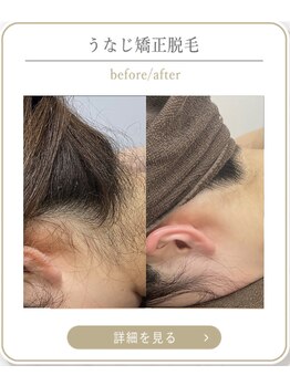 ミース 上野店/和装にぴったりのうなじ