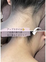 ツリービューティー(Tree Beauty)/★アップスタイル増える夏こそ★