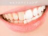 〈歯のセルフホワイトニング〉大人気!! 通常1回4500 → 特価3900