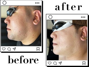 ホワイト(WHITE)/□Before～After〈顔〉