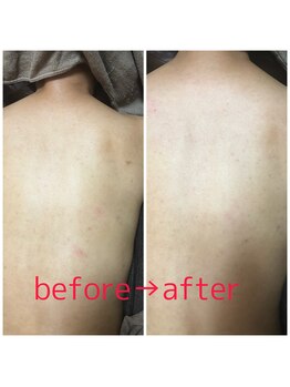 フェイスアンドフェム1058(Face&Femme1058)/