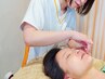 美容鍼 ★ 2回目以降の方はこちら！眼精疲労にも　￥9900→￥8800（40分）