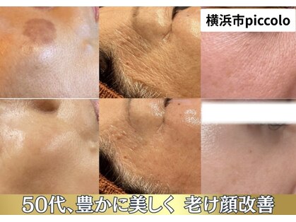 ピッコロ(piccolo)の写真