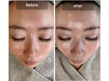 ブールドネージュ(Boule de Neige)/速攻小顔レモンボトル