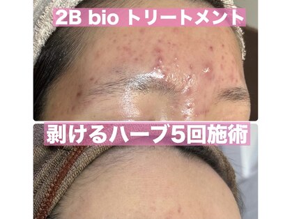 アブニールブリヨンの写真