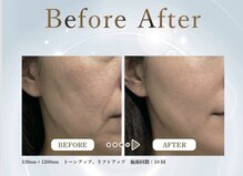 レリ ビューティラボ(Reli Beauty Lab)