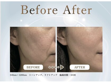 レリ ビューティラボ(Reli Beauty Lab)の写真