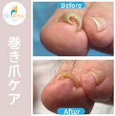 ドクターネイル爪革命 群馬両毛店