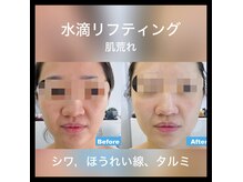 ココスタイルビューティー(COCOSTYLE beauty)の雰囲気(韓国発!ベビースキンの様みもっちり艶肌、)