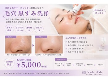 ヴィオレ パール(violet pale)の写真/【毛穴黒ずみ洗浄】お肌の表面の古い角質を除去することでターンオーバを促進!今後の肌トラベル予防にも。