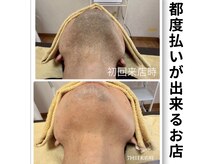 ティアレ 廿日市店(Tiare)の雰囲気（毎日の髭剃りから解放！肌荒れも解消！ストレスフリーに）