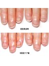 50代/女性/丸い爪