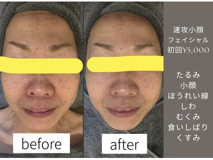 ほねつぎ一休さん 宇品店の写真