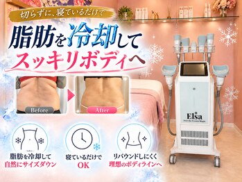 美痩身の写真/【痩身/脂肪冷却/ダイエット】気になる部分を集中ケア。リバウンドしにくいボディメイクを目指す脂肪冷却