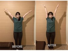 つばさ整体院 経堂駅前店/お客様ビフォーアフター