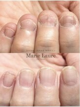 マリーロール 天王寺店(Marie Laure)/自爪育成/深爪矯正/ネイルケア