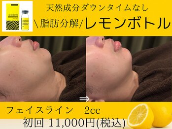 美々庵/レモンボトル/小顔/ブライダル