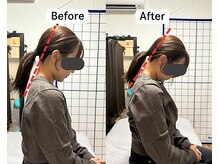 整体院 爽良/【札幌/大通り】小顔×首肩神経