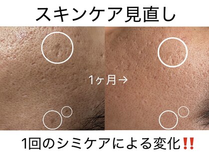 ルンルン(run run)の写真