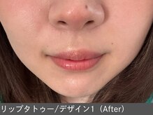 オアシスラグーン(OASIS LAGOON)/リップデザイン2（after）