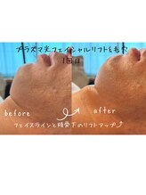 サロン リノ(salon rino)/プラズマ光フェイシャル