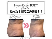 ワイキューマルサン(y903)