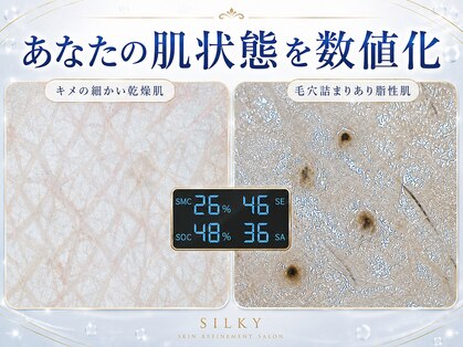 シルキー 新宿店(SILKY)の写真