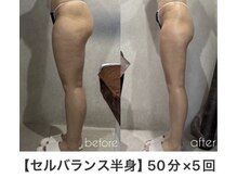 アーネスト 江坂店(EARNEST)/前張り、おしりのたるみケア