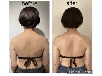 リラココ(リラcoco)/ビフォーアフター(40代お客様)